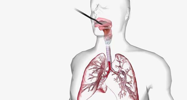 Bronchoscopy