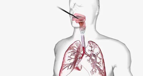 Bronchoscopy